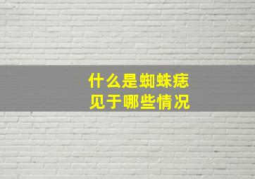 什么是蜘蛛痣 见于哪些情况